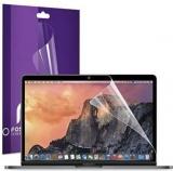 Fosmon Screen Guard For Apple Macbook