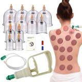 Acupunx Cupping Set With Pump 12 Cups Cupping Therapy Set Vacuum Suction Cups Massager For Cellulite Reduction Back Neck Joint Pain Relief, Chinese Hijama Cupping Set Massager